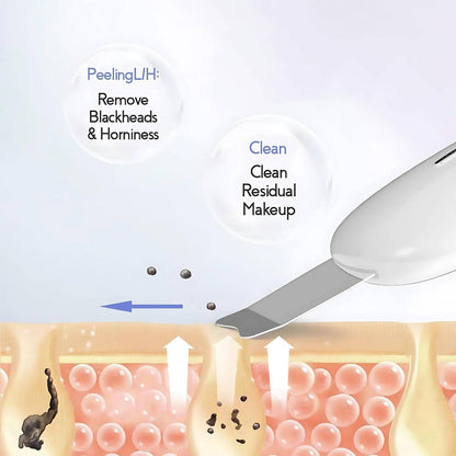 ULTRASONIC BEAUTY DEVICE